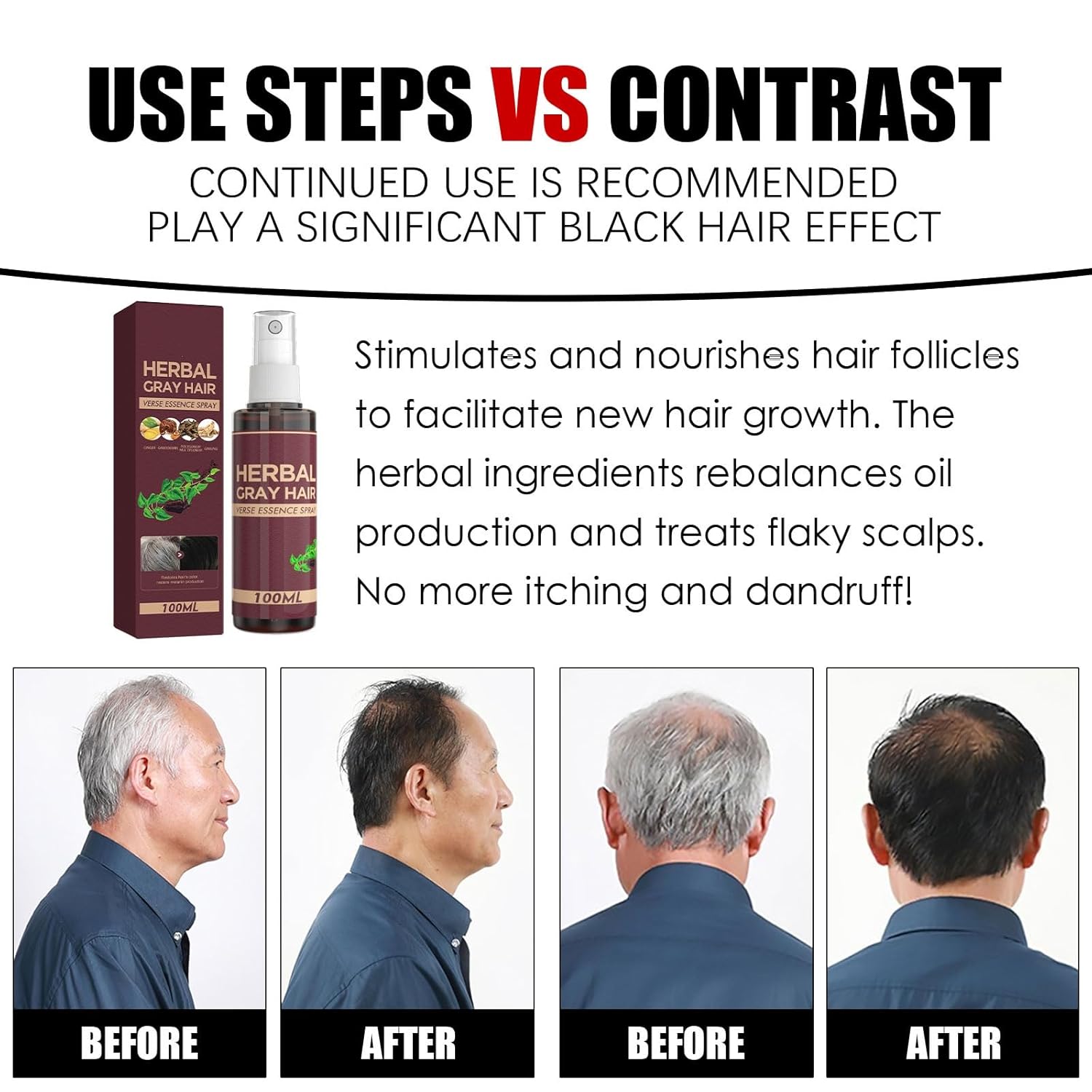 Herbal Gray Hair Verse Essence Spray – Natural Grey Hair Darkening Spray & Scalp Nourishing Treatment